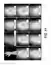 Fig. 15 - Apparatus and methods for determining damaged tissue using sub-epidermal moisture measurements