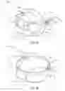 Fig. 04 - RESPIRATORY SAMPLING WITH SUPPORT STRUCTURE