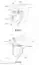 Fig. 06 - RESPIRATORY SAMPLING WITH SUPPORT STRUCTURE