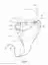 Fig. 07 - RESPIRATORY SAMPLING WITH SUPPORT STRUCTURE