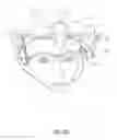 Fig. 09 - RESPIRATORY SAMPLING WITH SUPPORT STRUCTURE