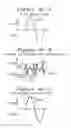 Fig. 06 - Apparatus and method for characterization of acute otitis media
