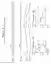 Fig. 08 - Apparatus and method for characterization of acute otitis media