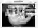 Fig. 01 - INTERDIGITAL DETECTION SYSTEM