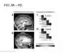 Fig. 09 - TASK-LESS OPTICAL MAPPING OF BRAIN FUNCTION USING RESTING STATE FUNCTIONAL CONNECTIVITY
