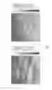 Fig. 08 - Dual modality imaging system for coregistered functional and anatomical mapping