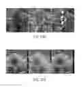 Fig. 29 - Dual modality imaging system for coregistered functional and anatomical mapping