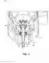 Fig. 04 - Biopsy device with automatic biopsy parameter adjustment