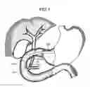 Fig. 02 - Method of inserting treatment tool