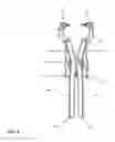 Fig. 09 - Method of using a surgical tissue retractor