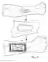Fig. 09 - Atraumatic wound care and closure system