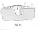 Fig. 10 - Atraumatic wound care and closure system
