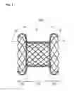Fig. 02 - Stent for connecting adjacent tissues and manufacturing method thereof