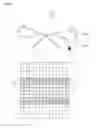 Fig. 15 - Stent for connecting adjacent tissues and manufacturing method thereof