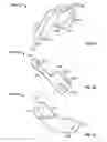 Fig. 16 - Surgical tool