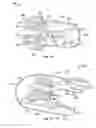 Fig. 08 - Surgical tool
