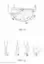 Fig. 02 - SYSTEMS AND METHODS FOR PROVIDING A FEMORAL RESECTION BLOCK