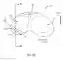 Fig. 09 - SYSTEMS AND METHODS FOR PROVIDING A FEMORAL RESECTION BLOCK
