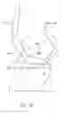 Fig. 32 - SYSTEMS AND METHODS FOR PROVIDING A FEMORAL RESECTION BLOCK