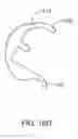 Fig. 41 - SYSTEMS AND METHODS FOR PROVIDING A FEMORAL RESECTION BLOCK