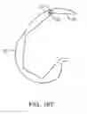 Fig. 43 - SYSTEMS AND METHODS FOR PROVIDING A FEMORAL RESECTION BLOCK