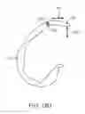 Fig. 44 - SYSTEMS AND METHODS FOR PROVIDING A FEMORAL RESECTION BLOCK