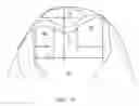 Fig. 50 - SYSTEMS AND METHODS FOR PROVIDING A FEMORAL RESECTION BLOCK