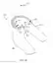 Fig. 67 - SYSTEMS AND METHODS FOR PROVIDING A FEMORAL RESECTION BLOCK