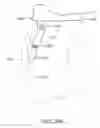 Fig. 72 - SYSTEMS AND METHODS FOR PROVIDING A FEMORAL RESECTION BLOCK
