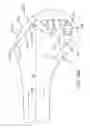Fig. 74 - SYSTEMS AND METHODS FOR PROVIDING A FEMORAL RESECTION BLOCK