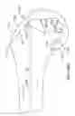 Fig. 75 - SYSTEMS AND METHODS FOR PROVIDING A FEMORAL RESECTION BLOCK