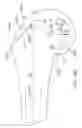 Fig. 76 - SYSTEMS AND METHODS FOR PROVIDING A FEMORAL RESECTION BLOCK