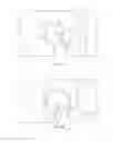 Fig. 06 - Patient-specific total hip arthroplasty