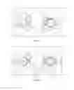 Fig. 07 - Patient-specific total hip arthroplasty