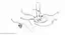 Fig. 01 - Microdermabrasion device and microdermabrasion method