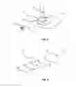 Fig. 02 - Microdermabrasion device and microdermabrasion method