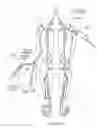 Fig. 40 - ATHERECTOMY DEVICES, SYSTEMS, AND METHODS