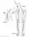 Fig. 41 - ATHERECTOMY DEVICES, SYSTEMS, AND METHODS