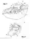 Fig. 02 - Access device with anchoring body and modular inserts and support structure for supporting accessories used in minimally invasive surgical procedures