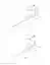 Fig. 02 - Expandable introducer sheath