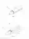 Fig. 06 - Expandable introducer sheath