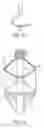 Fig. 08 - Intravascular treatment catheters