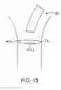 Fig. 09 - Intravascular treatment catheters