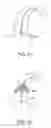 Fig. 35 - Intravascular treatment catheters