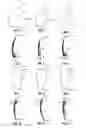 Fig. 02 - DENTAL VENEERS AND METHODS OF MANUFACTURE