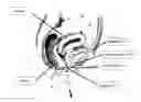 Fig. 01 - INTRAVAGINAL INCONTINENCE DEVICE