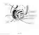 Fig. 03 - INTRAVAGINAL INCONTINENCE DEVICE