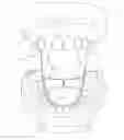 Fig. 01 - Intra-oral prostheses and other anatomical prostheses