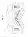 Fig. 06 - Intra-oral prostheses and other anatomical prostheses