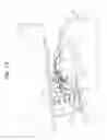 Fig. 07 - Intra-oral prostheses and other anatomical prostheses